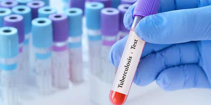 Cache Creek Casino Warns Visitors After Tribal Member Tests Positive for Tuberculosis